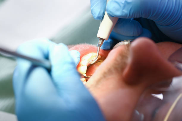 Tooth Infection Emergency Dentist in TN