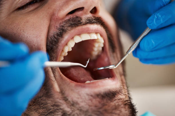 Best Cracked Tooth Emergency Dentist  in Selmer, TN